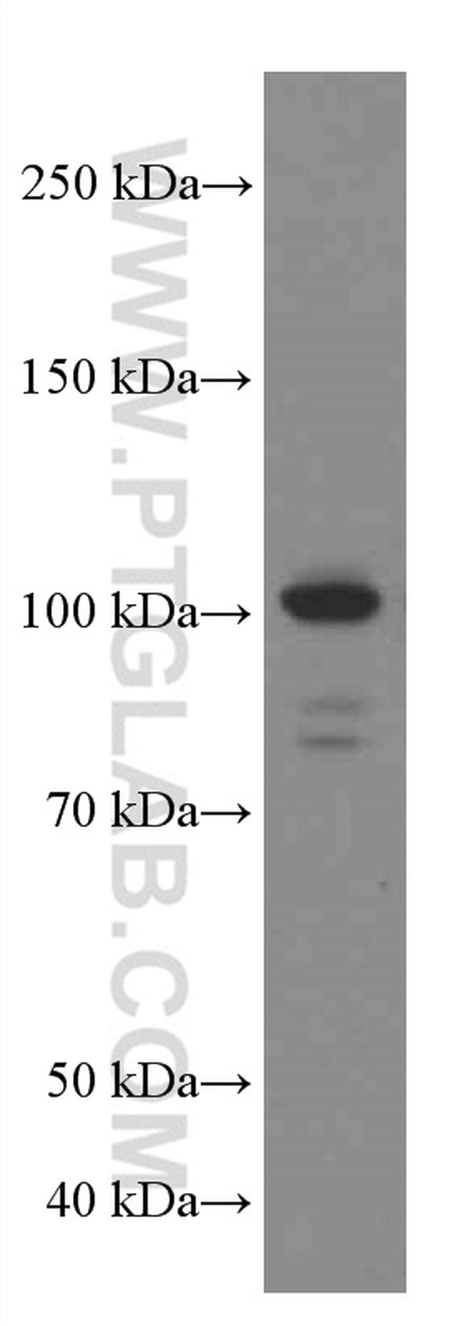 USP5 Antibody in Western Blot (WB)