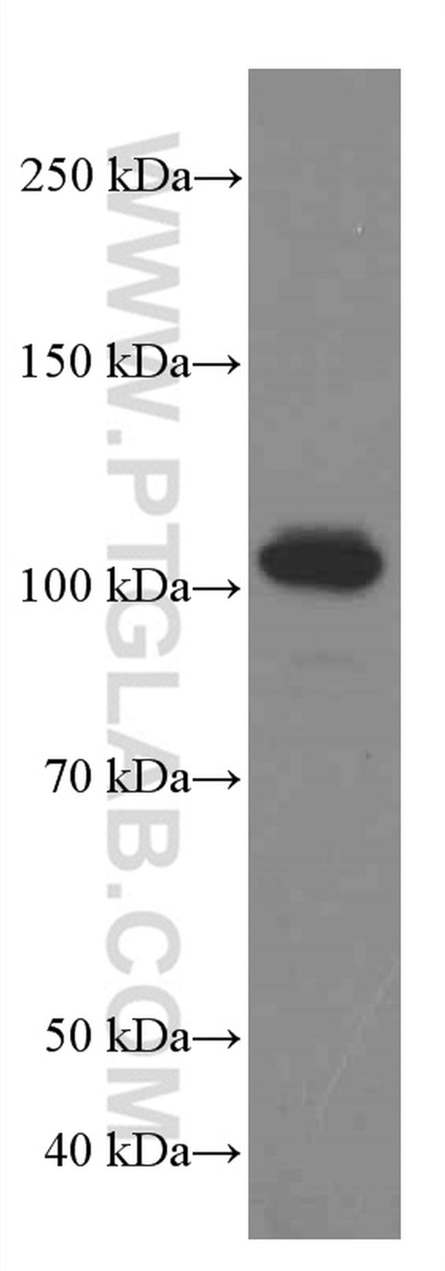 USP5 Antibody in Western Blot (WB)