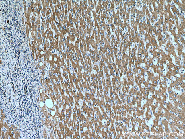 ORM2 Antibody in Immunohistochemistry (Paraffin) (IHC (P))