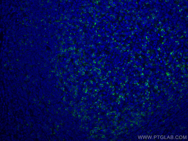 PD-1/CD279 Antibody in Immunohistochemistry (PFA fixed) (IHC (PFA))