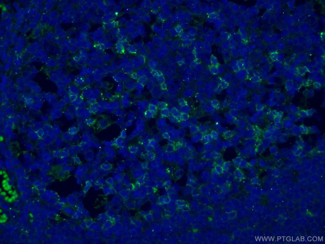 PD-1/CD279 Antibody in Immunohistochemistry (PFA fixed) (IHC (PFA))