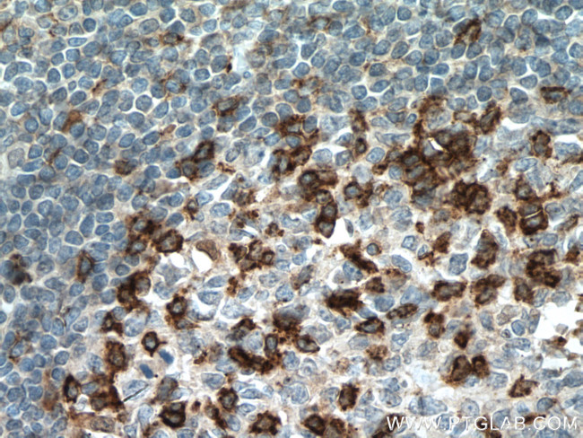 PD-1/CD279 Antibody in Immunohistochemistry (Paraffin) (IHC (P))