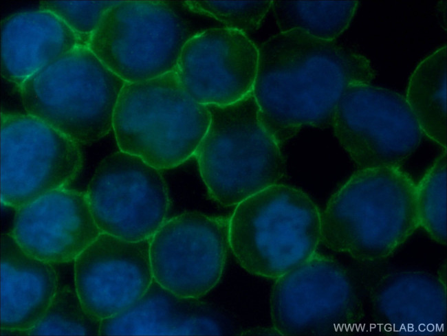 CD43 Antibody in Immunocytochemistry (ICC/IF)