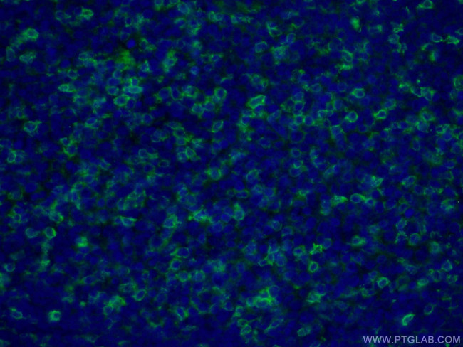 CD43 Antibody in Immunohistochemistry (PFA fixed) (IHC (PFA))