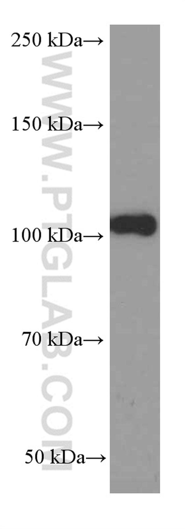 CD43 Antibody in Western Blot (WB)