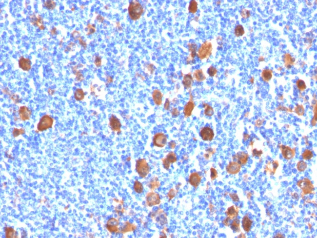 Fascin-1 (Reed-Sternberg Cell Marker) Antibody in Immunohistochemistry (Paraffin) (IHC (P))
