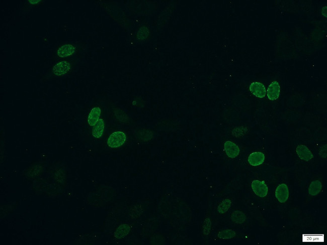 BrdU Antibody in Immunocytochemistry (ICC/IF)