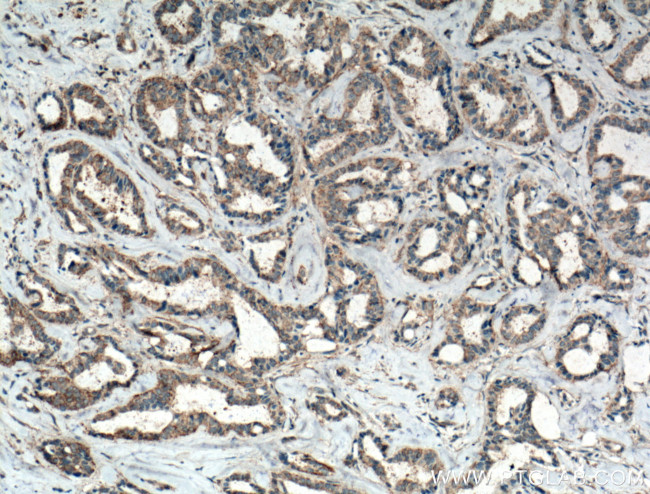 FAK Antibody in Immunohistochemistry (Paraffin) (IHC (P))