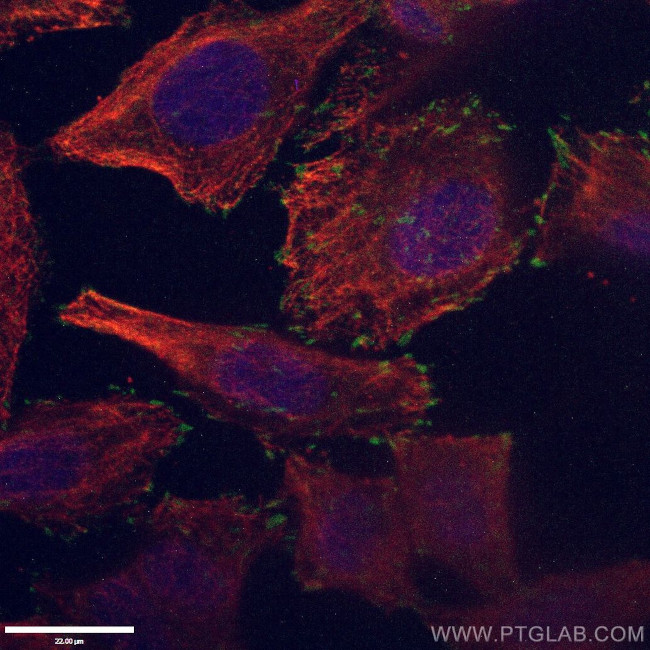 FAK Antibody in Immunocytochemistry (ICC/IF)