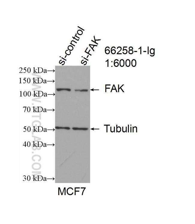 FAK Antibody in Western Blot (WB)