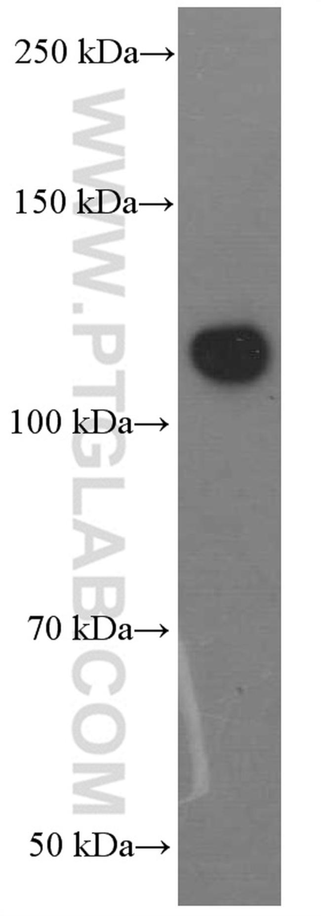 FAK Antibody in Western Blot (WB)