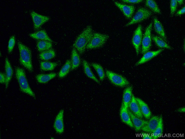 PAI-1 Antibody in Immunocytochemistry (ICC/IF)