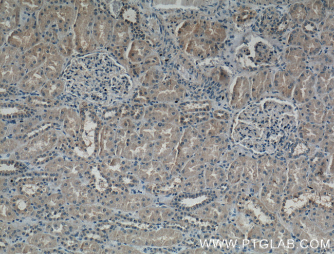 PAI-1 Antibody in Immunohistochemistry (Paraffin) (IHC (P))