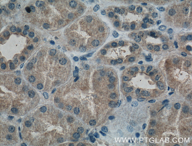 PAI-1 Antibody in Immunohistochemistry (Paraffin) (IHC (P))