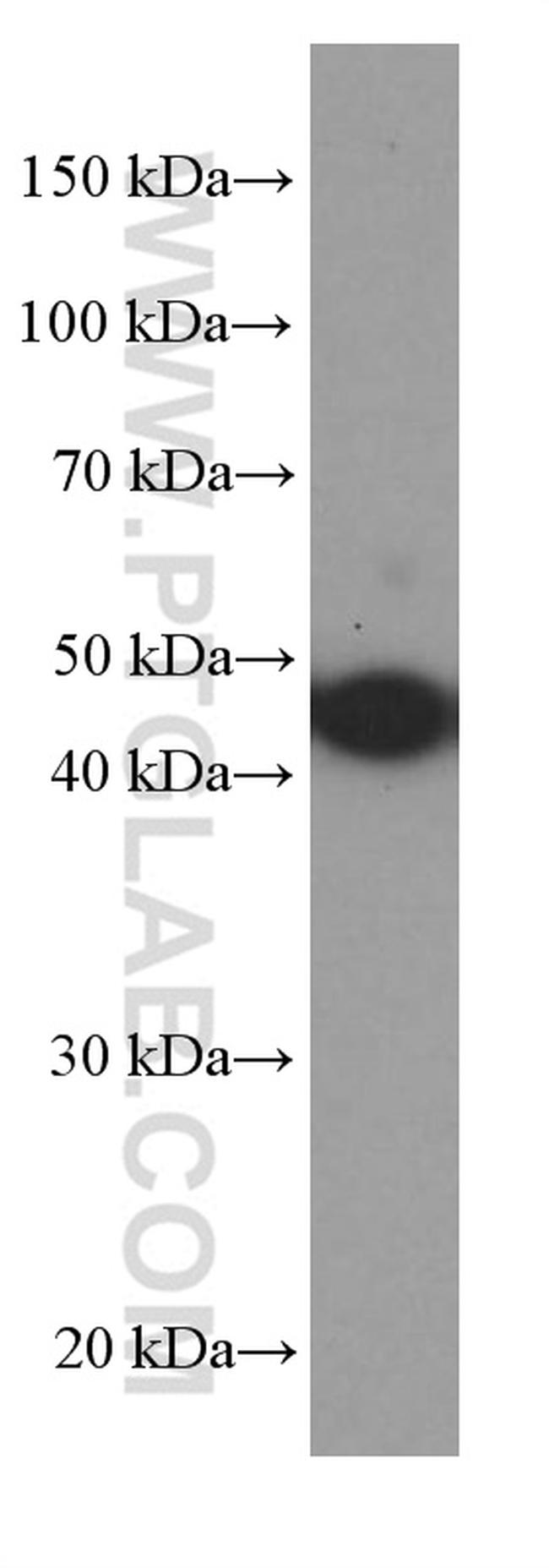 PAI-1 Antibody in Western Blot (WB)