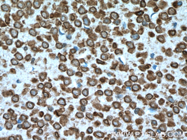 SRPX2 Antibody in Immunohistochemistry (Paraffin) (IHC (P))