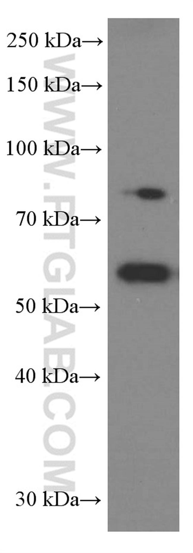 SRPX2 Antibody in Western Blot (WB)