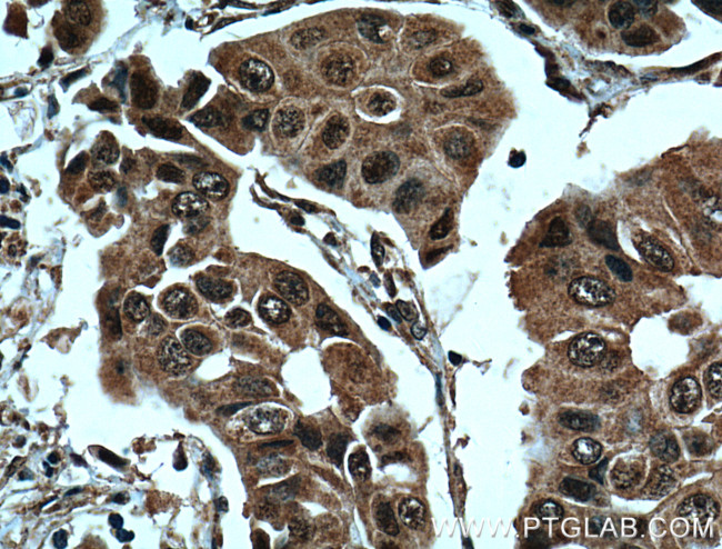 BRCA1 Antibody in Immunohistochemistry (Paraffin) (IHC (P))