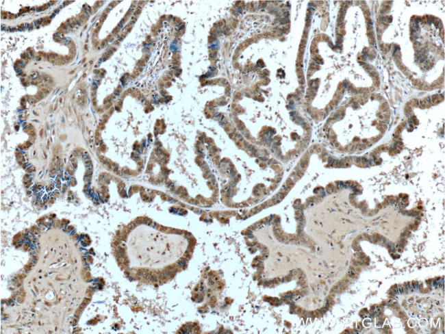 BRCA1 Antibody in Immunohistochemistry (Paraffin) (IHC (P))