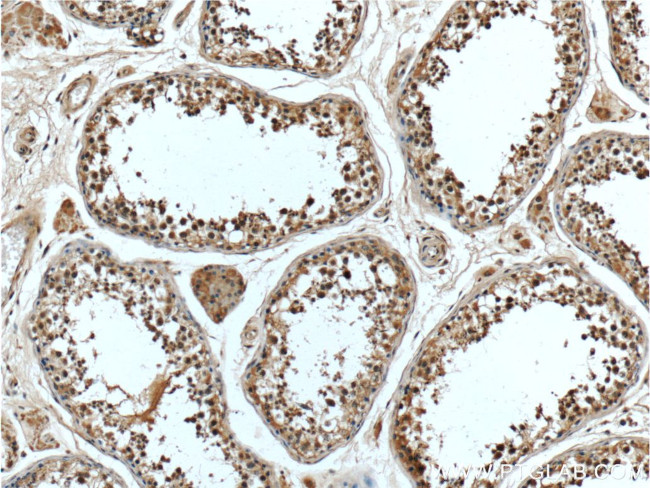 BRCA1 Antibody in Immunohistochemistry (Paraffin) (IHC (P))