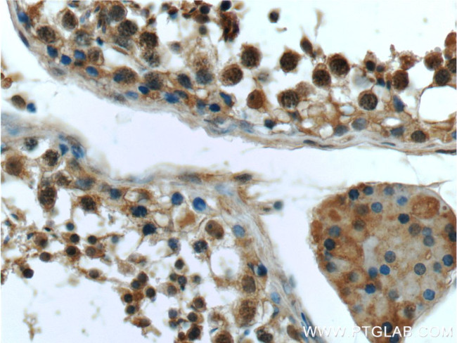 BRCA1 Antibody in Immunohistochemistry (Paraffin) (IHC (P))