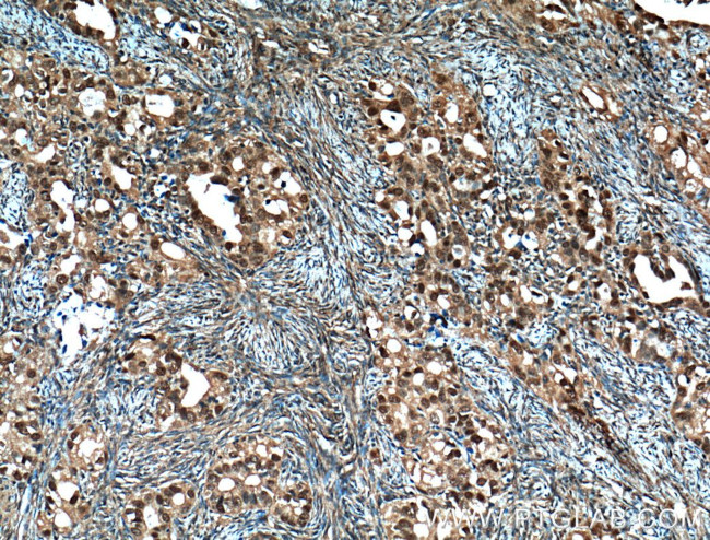 BRCA1 Antibody in Immunohistochemistry (Paraffin) (IHC (P))