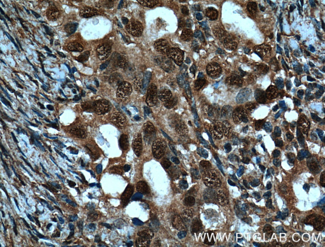 BRCA1 Antibody in Immunohistochemistry (Paraffin) (IHC (P))