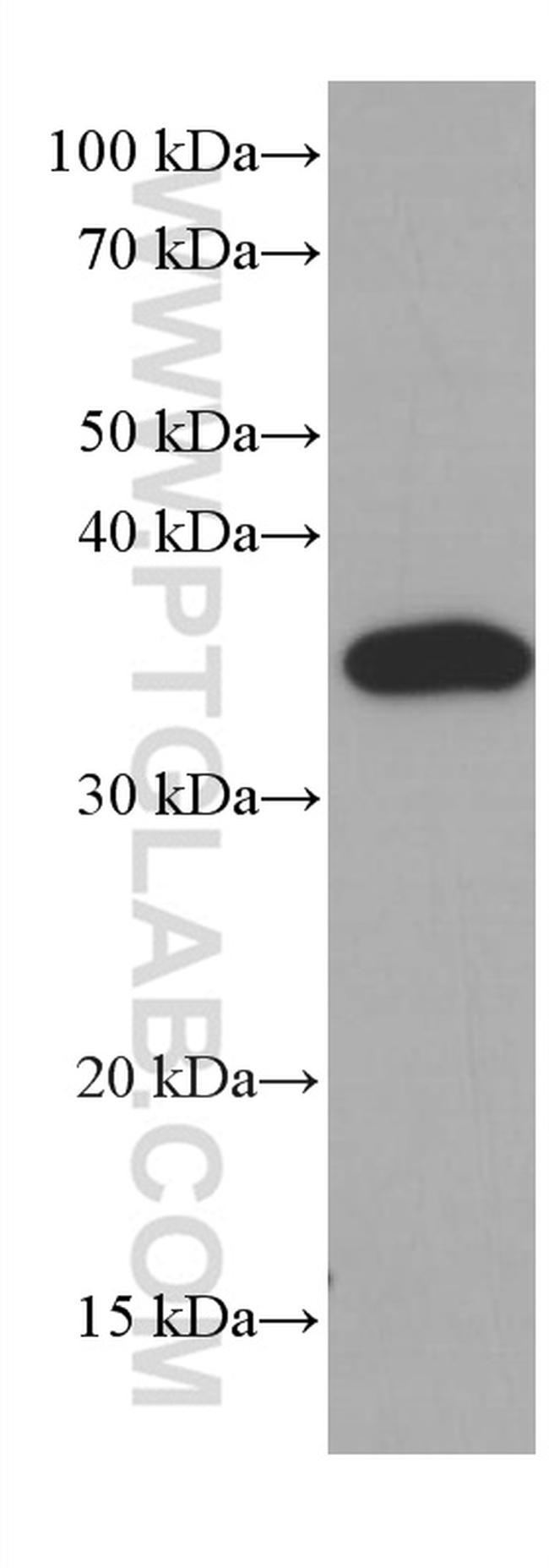 CDK6 Antibody in Western Blot (WB)