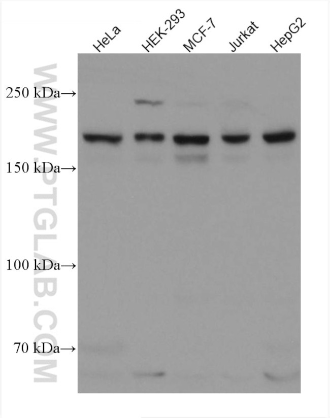 SETDB1 Antibody in Western Blot (WB)