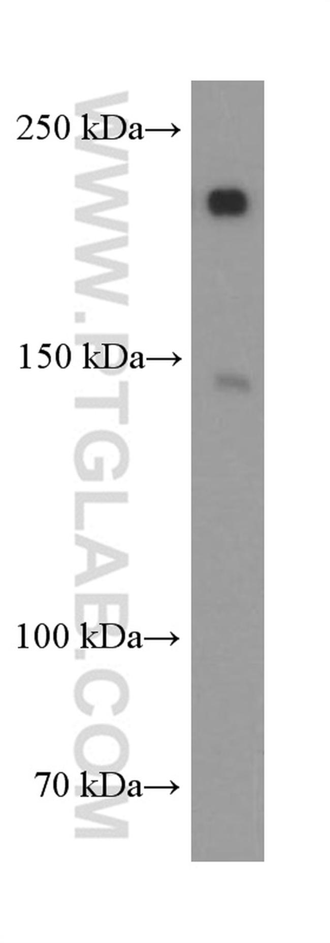 SETDB1 Antibody in Western Blot (WB)