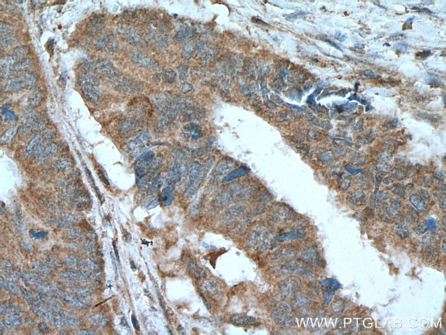 LIPH Antibody in Immunohistochemistry (Paraffin) (IHC (P))