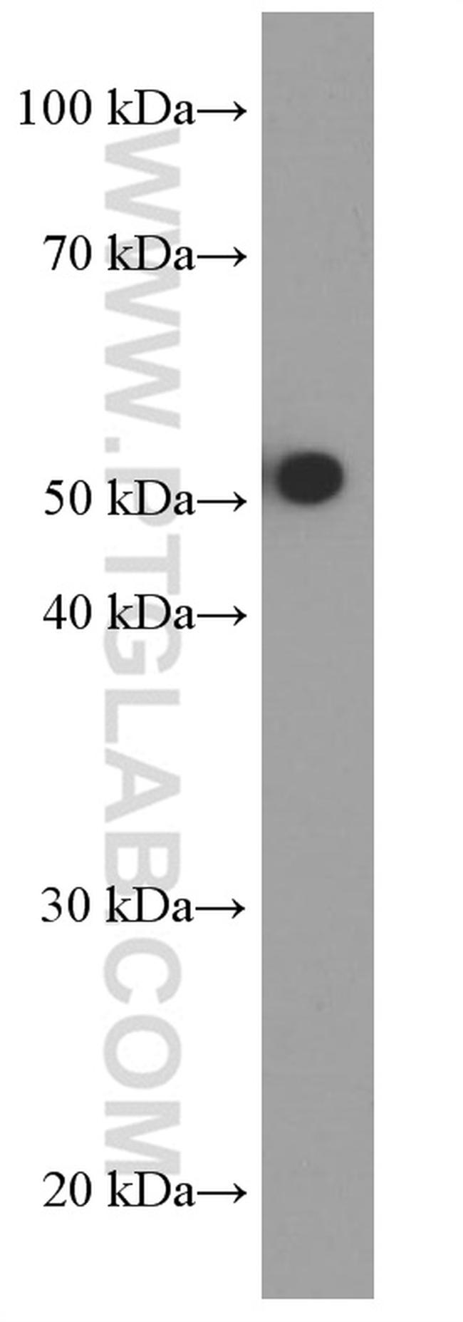 HEXIM1 Antibody in Western Blot (WB)