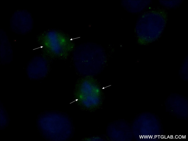 gamma tubulin Antibody in Immunocytochemistry (ICC/IF)