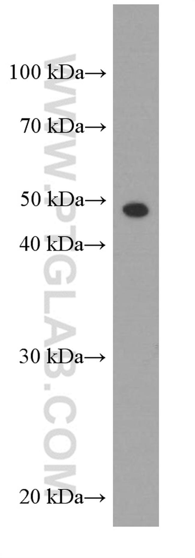 gamma tubulin Antibody in Western Blot (WB)