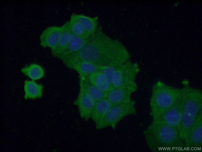 VPS37A Antibody in Immunocytochemistry (ICC/IF)