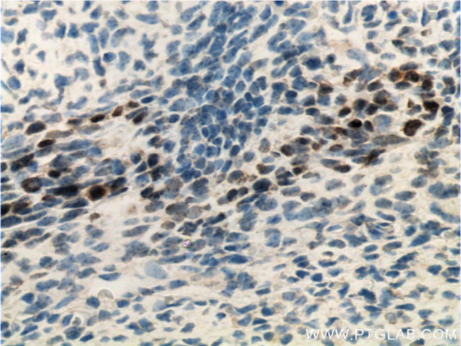 SIX2 Antibody in Immunohistochemistry (Paraffin) (IHC (P))