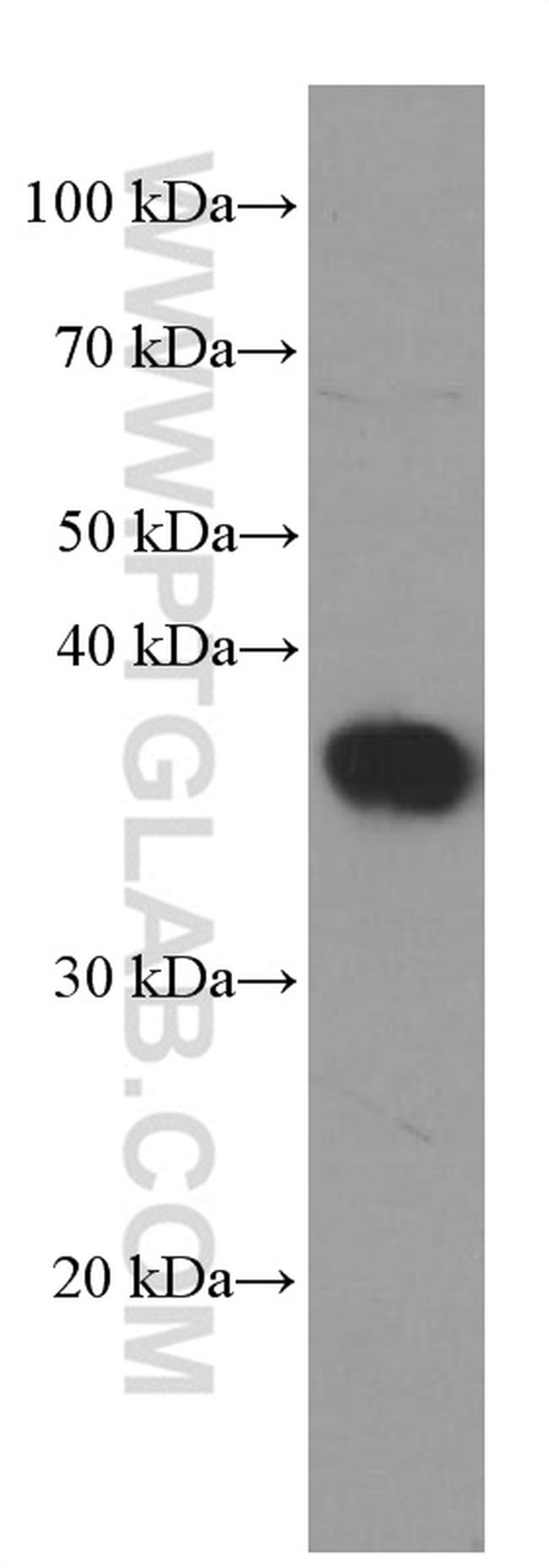 SIX2 Antibody in Western Blot (WB)