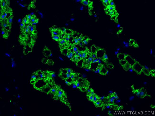 COX2/ Cyclooxygenase 2 Antibody in Immunohistochemistry (PFA fixed) (IHC (PFA))