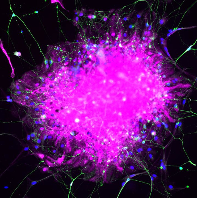 TUBB3 Antibody in Immunocytochemistry (ICC/IF)