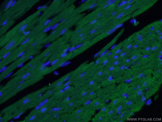 Cardiac Troponin I Antibody in Immunohistochemistry (PFA fixed) (IHC (PFA))