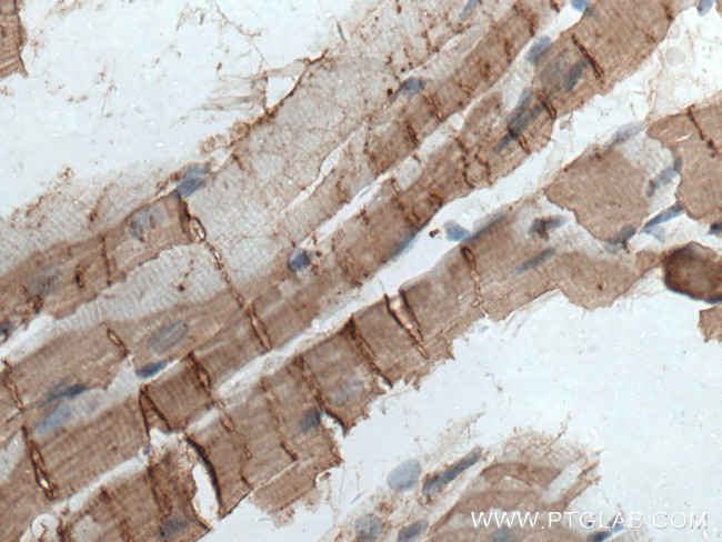 Cardiac Troponin I Antibody in Immunohistochemistry (Paraffin) (IHC (P))