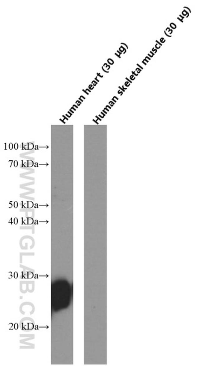 Cardiac Troponin I Antibody in Western Blot (WB)