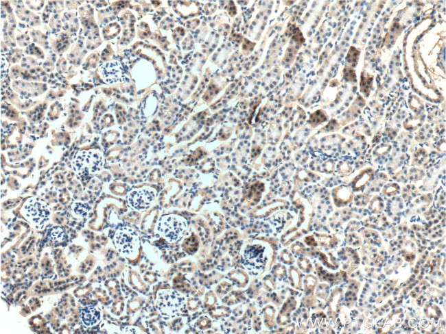 Occludin Antibody in Immunohistochemistry (Paraffin) (IHC (P))