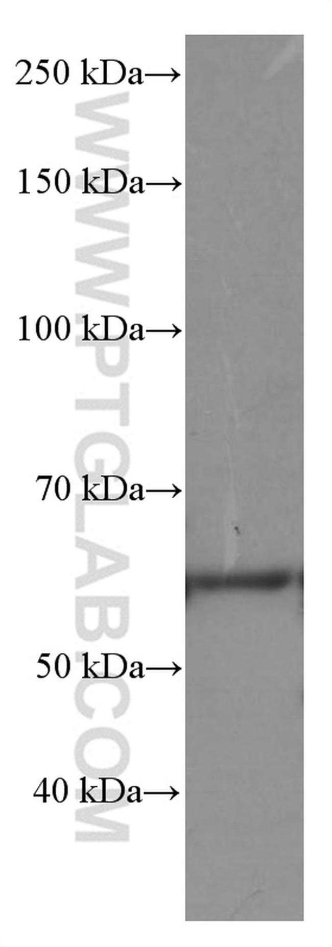 Occludin Antibody in Western Blot (WB)