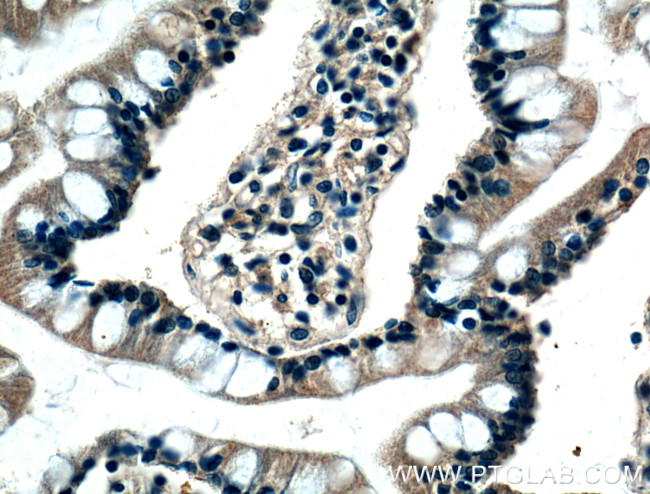 BMP2 Antibody in Immunohistochemistry (Paraffin) (IHC (P))