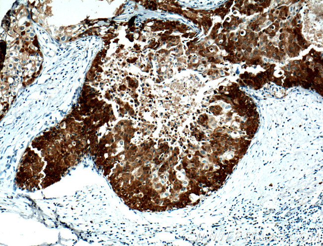 PADI2 Antibody in Immunohistochemistry (Paraffin) (IHC (P))