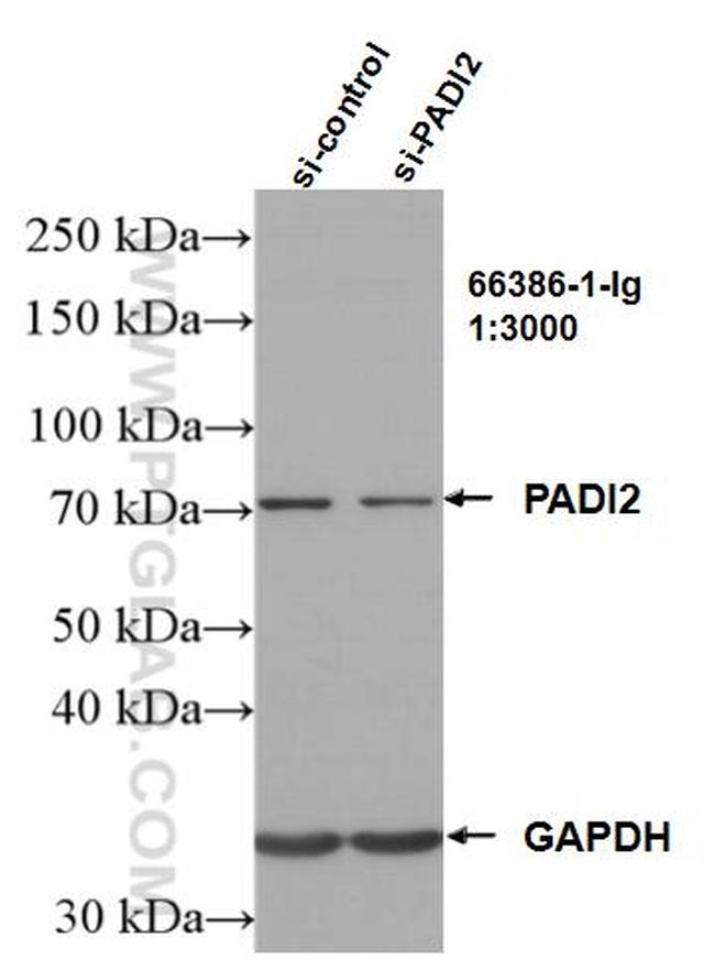 PADI2 Antibody in Western Blot (WB)