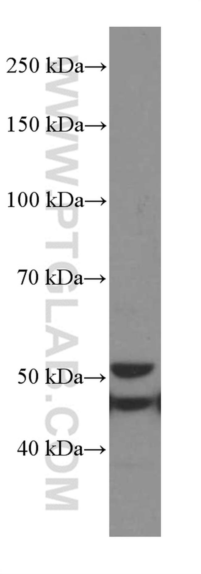 GSDMD Antibody in Western Blot (WB)