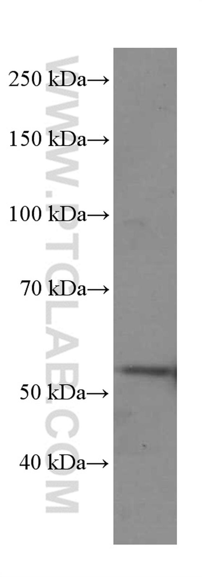 Cyclin A2 Antibody in Western Blot (WB)