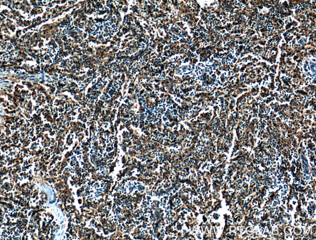 CD36 Antibody in Immunohistochemistry (Paraffin) (IHC (P))